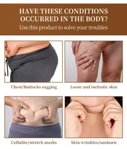 Graphique de détail montrant la cellulite, le relâchement cutané et les rides du corps.