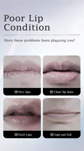 Lip plumper detail view showing dry lips, lip lines, and dull lip condition close up.