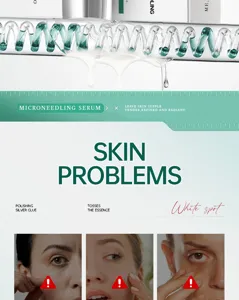 Microneedling facial serum for skin problems, moisturizing and hydrating skincare.