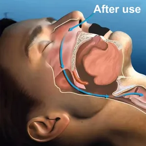 Detailed anatomical diagram showing airflow correction after using anti snoring mouth tape.