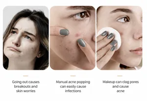 Acne patch skincare routine and problem illustration showing clear skin care steps details