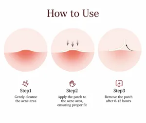Detailed illustration showing the step-by-step application guide for star acne patch.
