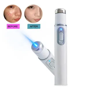 KD-7910 Blaulicht Akne Laser Stift Tragbar Gesichts Hautpflege Schoenheit Geraet Tool