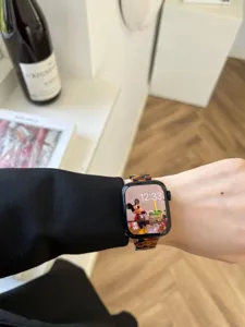 Detailaufnahme des stilvollen Harz-Uhrenarmbands mit speziellem Muster am Handgelenk.