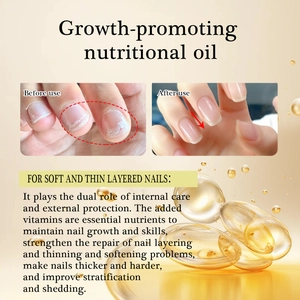 Growth nail oil treatment for thin brittle nails with before and after repair results