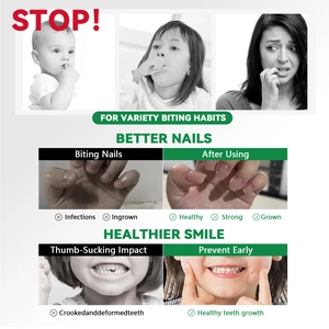 Trattamento contro l'onicofagia per bambini e adulti per prevenire denti storti