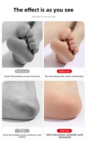 Detail showing the transformation of dry cracked heels to smooth skin after exfoliation