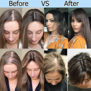 Before and after comparison of synthetic hairpiece for volume and gray hair coverage