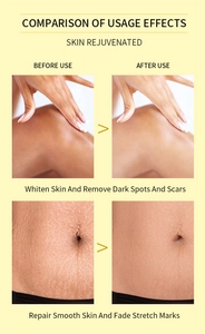 Peeling oil before and after comparison showing skin brightening and scar removal
