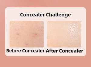 Detailed comparison showing foundation coverage before and after on skin with red blemishes