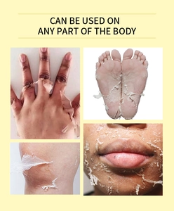 Peeling oil showing skin exfoliation effects on hands, feet, neck and face