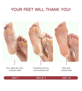 Exfoliating foot mask 14-day progress showing peeling process and smooth results