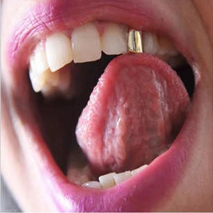 Grillz hip hop per dente singolo placcato in oro accessorio decorativo dentale unisex
