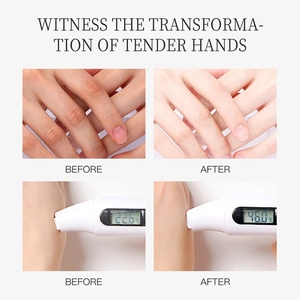 Moisture test comparison showing green tea hand cream hydration increase from 22.6% to 46.0%