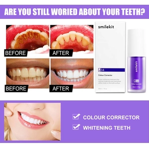 Smilekit V34 teeth whitening serum showing before-after results and 30ml purple bottle