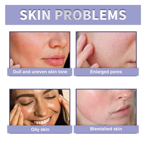 Matte setting powder showing solutions for dull skin, oily skin, and enlarged pores