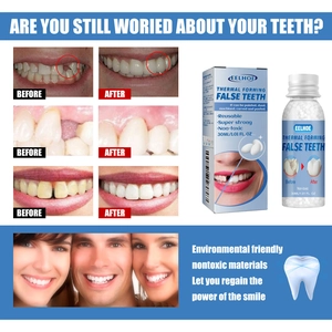Risultati prima e dopo la riparazione dei denti con perle termoplastiche modellabili