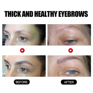 Detaillierter Vorher-Nachher-Vergleich für dickere und gesündere Augenbrauen-Ergebnisse