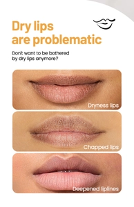 Infographic showing dry, chapped lips and deep lip lines for specialized lip care treatment