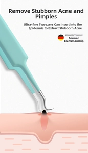 Macro detail of mint green precision cell tweezers removing blackheads from pores