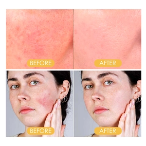 EELHOE Puder bietet natürliche leichte Ölkontrolle für langanhaltend makelloses Make-up.