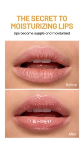 Moisturizing lip balm set showing before and after results for dry lip repair
