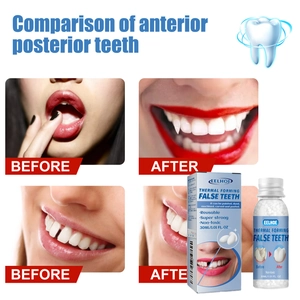 Confronto prima e dopo delle perle a formatura termica da 30ml per riparazione denti