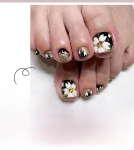 Detail of short French toenail press-ons with white flowers, gold glitter and black base