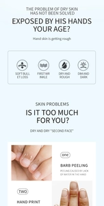 Infographic over handhuidproblemen zoals droogheid, schilfering en ruwe textuurdetails