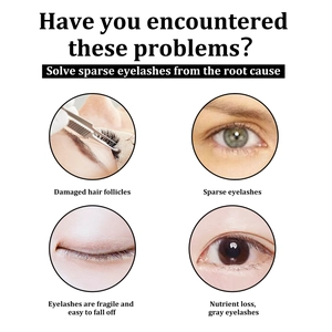 Infografik zu Wimpernproblemen wie dünnen Wimpern und beschädigten Haarfollikeln.