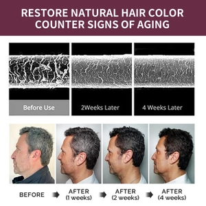 Infographic showing hair restoration results from 1 to 4 weeks using He Shou Wu soap