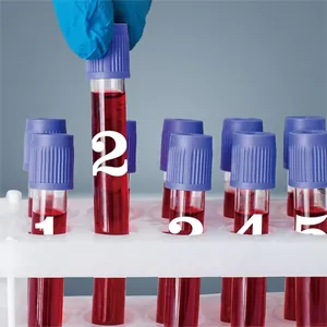 Gros plan de tubes EDTA avec bouchons violets et liquide rouge sur support blanc