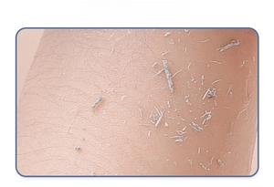 Macro close-up showing the effective exfoliating and deep cleaning action on skin