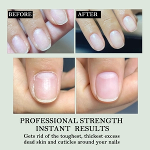 Aloe vera nail cuticle softener and repair oil showing professional before and after results