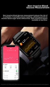 Macro view of the ET570 smartwatch interface showing non-invasive blood glucose tracking app