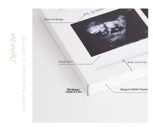 Close-up of baby ultrasound frame with 2cm wide white plexiglass molding detail