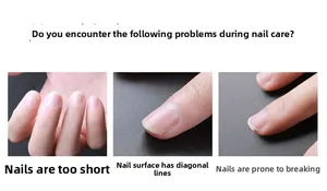 Detalle macro de uñas cortas, estrías y bordes agrietados para tratamiento manicura