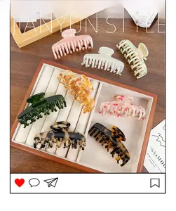 Close-up of assorted acetate claw clips with shell and marble patterns in a tray