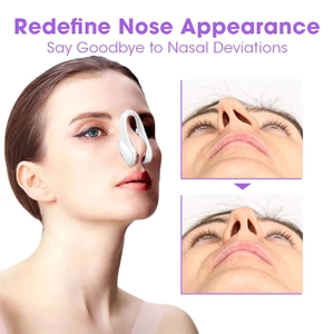 White nose shaper clip for lifting and contouring with before and after results