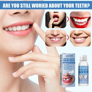 Perle dentali modellabili EELHOE per riparazione temporanea con risultati prima e dopo