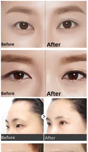 Double eyelid styling cream before and after results showing natural invisible effect