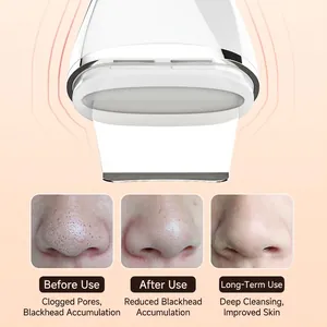 Ultrasonic skin scrubber for deep pore cleansing and blackhead removal in white finish