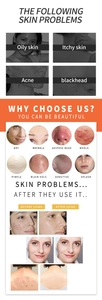 Infographic showing before and after results of kojic acid soap on acne and skin texture
