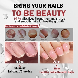 Effective nail repair serum for damaged nails before and after results overview