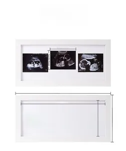 Detailed view of white triple sonogram frame with trimester labels and size specifications