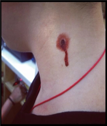 Adesivi Per Tatuaggi Temporanei Halloween Impermeabili Cicatrici Finte Realistiche Ferite Punti Sangue Trucco Per Scherzi