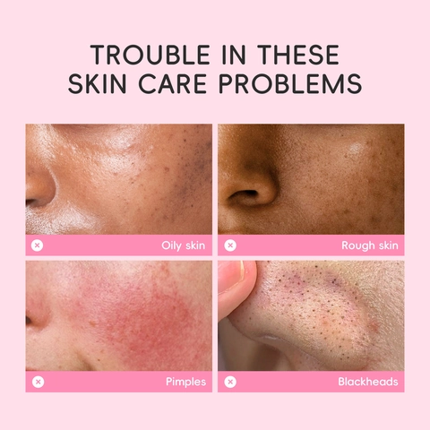 Sakura Mud Mask For Pore Cleaning Hydrating And Oil Control Face Skin Care Portable Single Use Travel Sachet