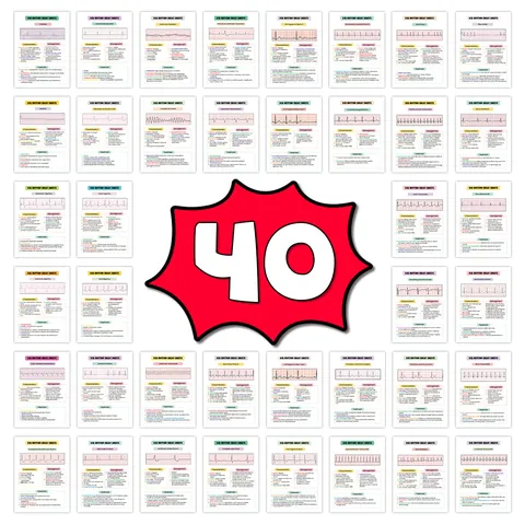 Κάρτες Αναφοράς Ρυθμού ECG Νοσηλευτικής Flashcards Ιατρικός Οδηγός Μελέτης Σετ Καρτών Τσέπης για Φοιτητές και Επαγγελματίες