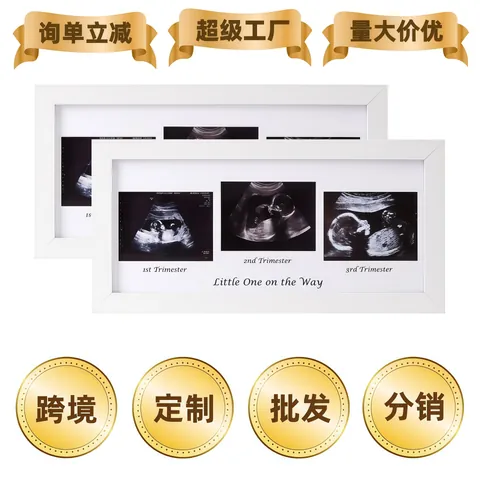Cadre Photo Échographie Bois MDF Plexiglas Grossesse Souvenir Décoration Chambre Bébé Blanc