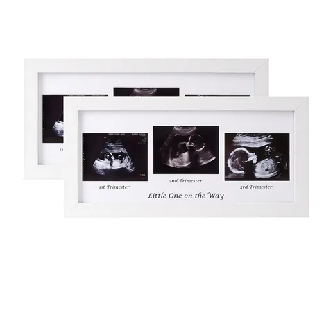Sonogramm Bilderrahmen MDF Holz Plexiglas Schwangerschaft Ultraschall Foto Gedenken Kinderzimmer Weiß